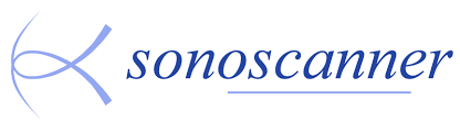 SONOSCANNER